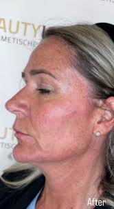 Beauty Icon Almere in Almere-Buiten