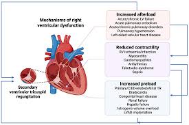 Image result for Right Heart Failure