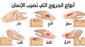 تصبح على بينة علم الأنساب رمال تنظيف الجرح allseasonsoutdoorkitchens com