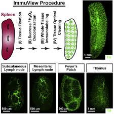 The spleen's primary functions are to filter the blood and help defend the body against pathogens. Panicle Shaped Sympathetic Architecture In The Spleen Parenchyma Modulates Antibacterial Innate Immunity Sciencedirect