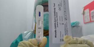 Begini Cara Kerja Rapid Test Deteksi Covid 19 Dari Tracking Di Maluku Terasmaluku Com Semua Membacanya