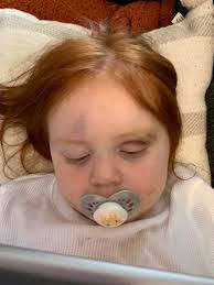 EDIT, The jogger has been in touch and is fine bumps, bruses and  unfortunately a glued head, he was so nice towards my son, very reasonable  and forgiving more so than alot