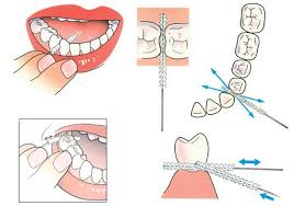 Maybe you would like to learn more about one of these? Ontstoken Tandvlees Tandartsenpraktijk Adding Heeft Advies