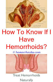 How to use hemorrhoid suppositories. How Does A Hemorrhoid Suppository Work Bleeding Hemorrhoids Getting Rid Of Hemorrhoids Hemorrhoid Remedies