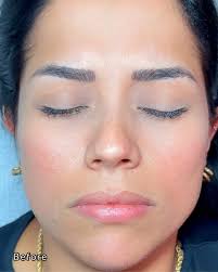 Corrección con NanoBlading👌 Esta belleza llegó con un tatuaje antiguo de  cejas en tonos gris azulado, hecho por otro profesional. En una sola sesión  logré transformar y corregir completamente la forma y