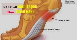 Check spelling or type a new query. Gel Amani Ipoh Sakit Di Bahagian Tumit Atau Tapak Kaki Facebook