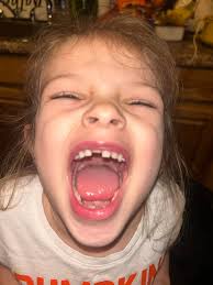 Ava lost her first tooth ! Tooth fairy time🧚‍♀️🪄