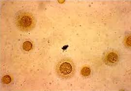 Image result for Mycoplasma