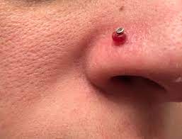 Nose Piercing Bump Album On Imgur