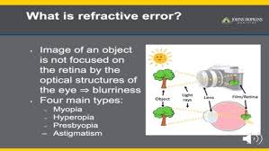 Image result for Refractive Error