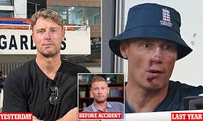 Freddie Flintoff displays his healing facial injuries as he films second  series of Field Of Dreams in India after horror Top Gear crash