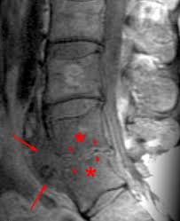They typically connect many networks. Discitis Radsource
