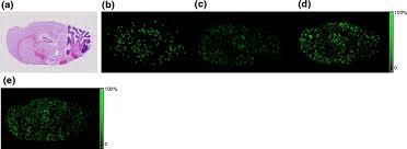 Imaging MALDI MS of Dosed Brain Tissues Utilizing an Alternative Analyte  Pre-extraction Approach