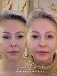 Reel by Dr. ANNA SAVINA (@annasavina.permanent) · October 20, 2025