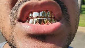 Should i win the lottery, however. Custom Grillz Clt Jeweler Dentist