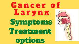 What are the signs of throat (laryngeal) cancer? Cancer Of Larynx Laryngeal Cancer Symptoms Of Laryngeal Carcinoma Treatment For Larynx Cancer Youtube