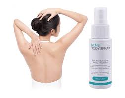 Namun dalam artikel ini, blog inkesehatan hanya akan berbagi tips menghilangkan jerawat secara alami dengan menggunakan. Ubat Hilangkan Jerawat Di Badan Posts Facebook