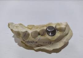 Pin En Aprendiendo Odontologia Odontologia Para Todos
