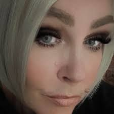 Back at emergency vets yesterday with Bonnie 2nd discolated shoulder anyone  else's had this which I think will now be a problem for her all she did was  bow down