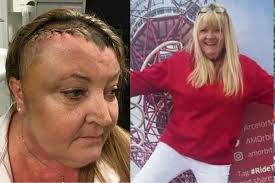 Brain tumour mum turned away by doctors TEN times and told it was just the  menopause