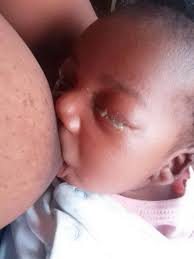 Hi, any suggestions for a natural approach to a sty in my 15 month old boys  eye, breast milk in the eye and natural vitamin c already. Any others ?