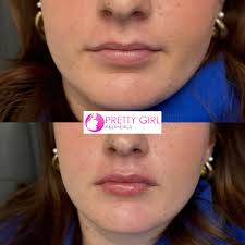 Pretty Girl Aesthetics