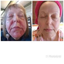 Perfect for trouble areas