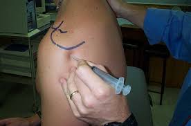 Image result for Shoulder Injection
