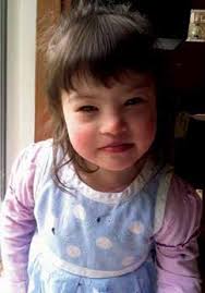 Families' experiences with Down syndrome and heart surgery