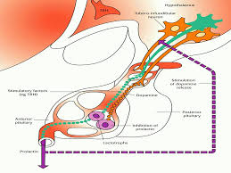 Image result for Hyperprolactinemia