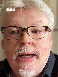 Simon Weston
