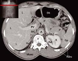 Ct anatomy of the pelvis. Abdominal Ct Anatomy Radiology Key