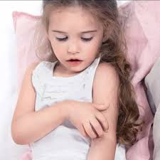 Daca un copil sau o persoana adulta este alergic/a la alune este foarte putin probabil ca acesta sa nu fie alergic si la celelalte produse din aceasta familie (nuci, mogdale, arahide etc.), motiv pentru care medicul alergolog ne sfatuieste le sa evitam complet. Alergia La Copii Des Intalnita De Catre Medicul Alergolog