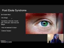 Post Ebola Virus Syndrome Youtube