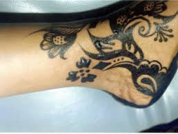 A professional henna artist available to do custom, temporary body art for your special occasion. Black Henna Tattoo Reaction Dermnet Nz