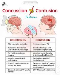 Image result for Brain Contusion