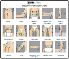 Tens Unit Electrode Placement Chart For Different Sports