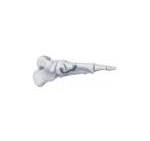 MT First MTC Plantar Fusion Locking Plate,Medical Device ...