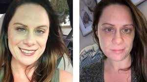 Fundraiser by Jessica Wick Brain Balance of Jacksonville : Jessica Wick's  Lyme Disease Battle