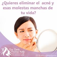 El acné es una...