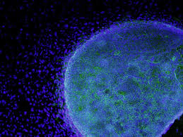 Human Embryonic Stem Cell Stem Cell Research Stem Cell Therapy Stem Cells
