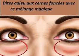 Un Melange Magique A Base De Deux Huiles Super Efficaces Pour Eliminer Les Cernes Foncee En Hydratant La Natural Face Moisturizer Diy Beauty Hacks Make Beauty