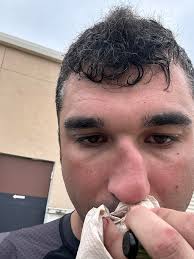 How to handle a broken nose during BJJ training?