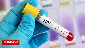 This process, which is carried out in seven steps or stages, is called the hiv life cycle. Hiv Findings In Dr Congo Give Hope For Cure Bbc News