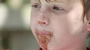 Brothers with rare Dias Logan syndrome build skills through therapy