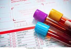 Hoje vamos falar um pouco sobre os exames complementares!acesse: Voce Sabe Qual A Importancia Dos Exames Laboratoriais Para Diagnostico De Doencas Silenciosas Clique E Descubra Newslab