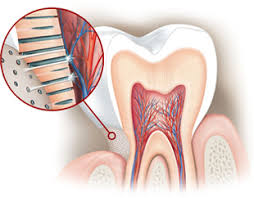 Refluxo prejudica o esmalte dental
