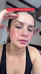 La Roche Posay Niacinamide 10 #niacinamide10 #larocheposay  #larocheposayskincare #skincareroutine #skincaretips #skincarenight  #rutinadenoche #rutinadenocheparadormir #larocheposayniacinamide10