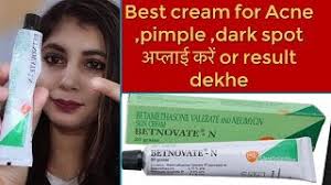 Batnovate N Cream Review Suhanigupta Youtube Betnovate sa hona wala nuqsan like cancer plz dont use thia cream for fairness betnovate n,review betnovate cream review in tamil | skin whitening & brightening. batnovate n cream review suhanigupta