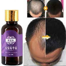 How we found the best hair growth products for black hair. Buy Online Hair Loss Products Natural With No Side Effects Grow Hair Faster Regrowth Hair Growth Products Alitools